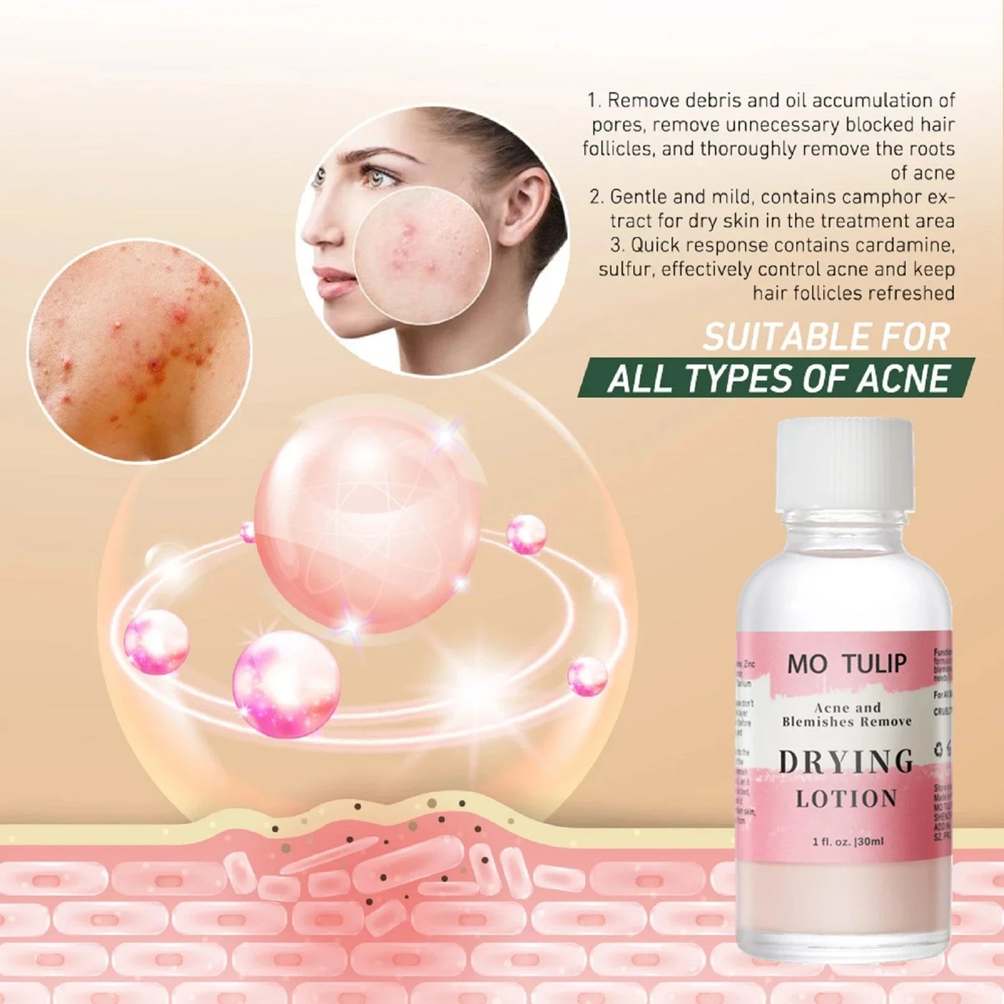 Fast Acting Acne Treatment - Pore Drying Lotion